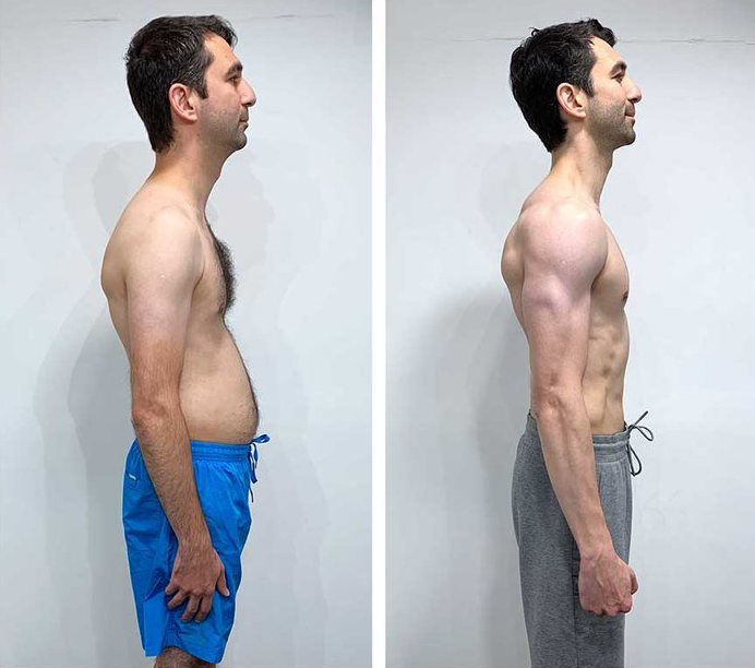 Alizier-before-after-8weeks-side