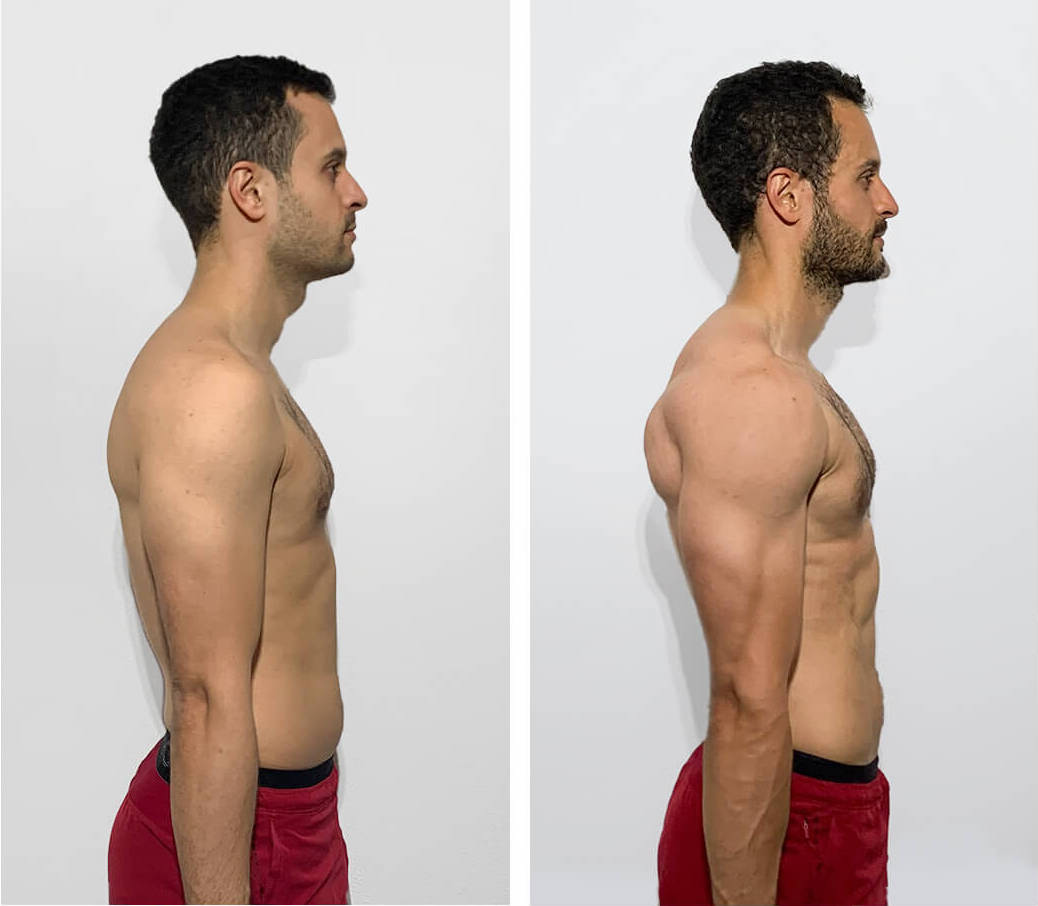 Asim-before-after-10weeks-side