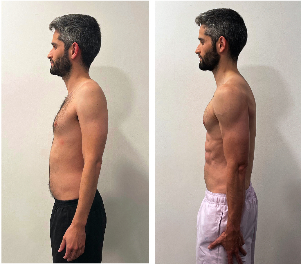 Chris-before-after -12 weeks- side