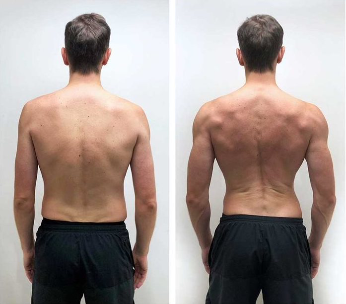 Christopher - before-after - 8 weeks - back