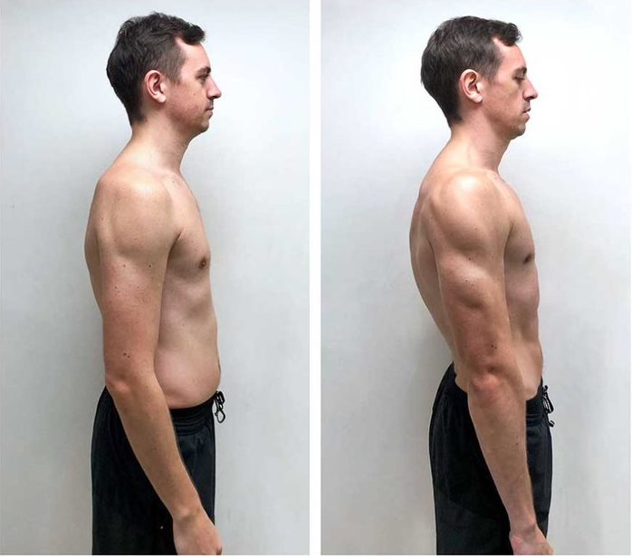 Christopher - before-after - 8 weeks - side