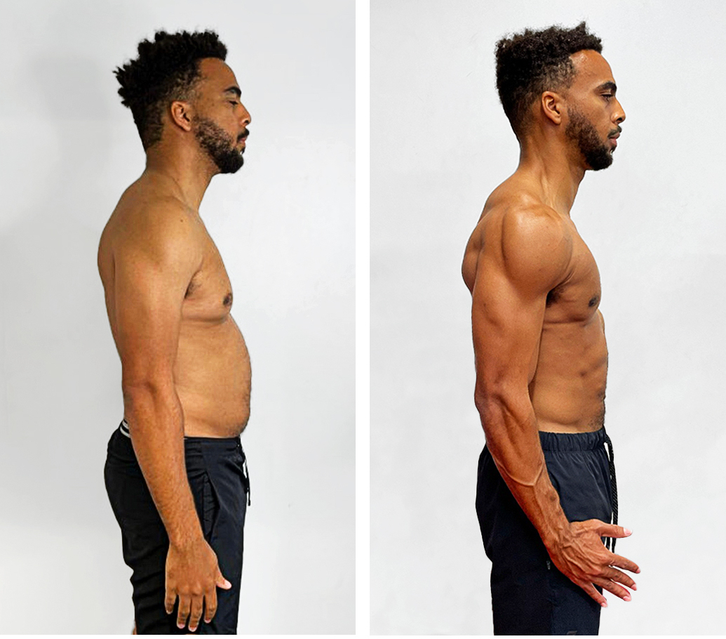 Daniel-before-after-19weeks-side